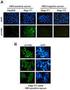 Enzygnost Anti-HBc monoclonal