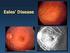 Geriatrik Olgularda Akut Kolesistit Tedavisinde Ultrasonografi Kılavuzluğunda Perkütan Kolesistostominin Yeri