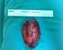 İlk kez Adison ve Brown-Sequard ın adrenal dokudan minerolokortikoid. Hangi adrenal kitlelere cerrahi ve nasıl? Adrenal surgery: to whom and how?